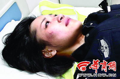 26歲女交警被違法車碾斷胳膊淚求醫生別剪警服