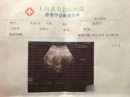 袁莉老公曝妻懷孕一月,曬其B超照。