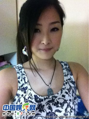 有人爆料指張名雅做過(guò)四次整形手術(shù)，還提供了一張疑似張名雅的舊照(左圖)