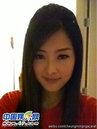有人爆料指張名雅做過(guò)四次整形手術(shù)，還提供了一張疑似張名雅的舊照(左圖)