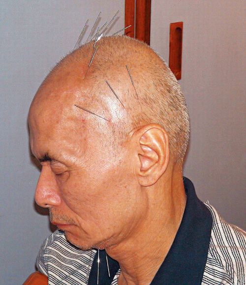 探秘劉家輝老人院生活：親證子女謀產 治療吃盡苦頭