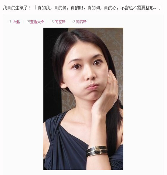 獨家：林志玲怒斥整容傳聞 皮膚科醫生出證明證未整容