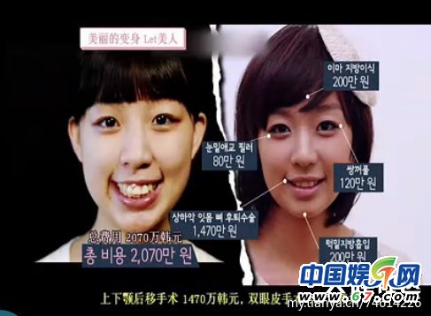多圖劇透韓國整容節(jié)目《LET 美人》近幾期，最愛小V臉，人瘦就能美
