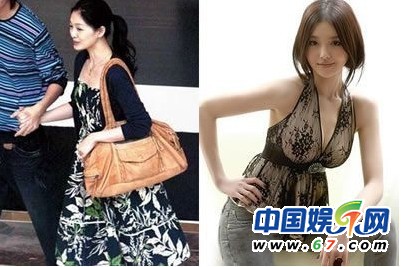 女星豐胸術