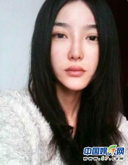 李穎芝整容前清楚照曝光 網友：鄰家小妹變蛇妖
