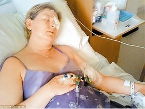 愛爾康隱形眼鏡致真菌感染 22次手術痛失左眼