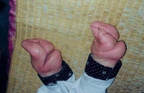 三寸金蓮背后的秘密：濃含性意識
